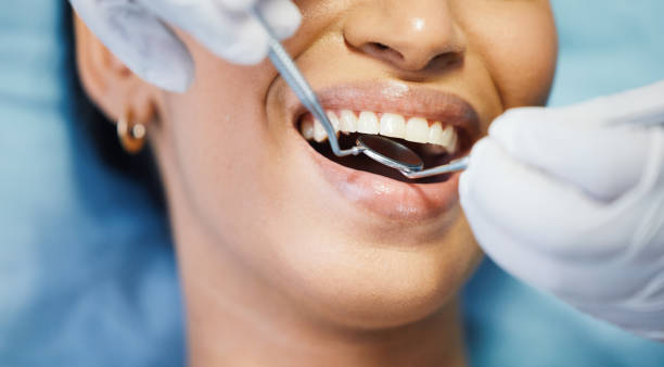 Best Emergency Dentist for Lost Fillings or Crowns in Wilson Conococheague, MD